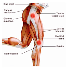 behandeling runners knee