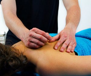 Verschillen dryneedling therapie en acupunctuur