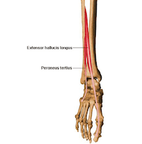 Tibialis anterior tendinopathie